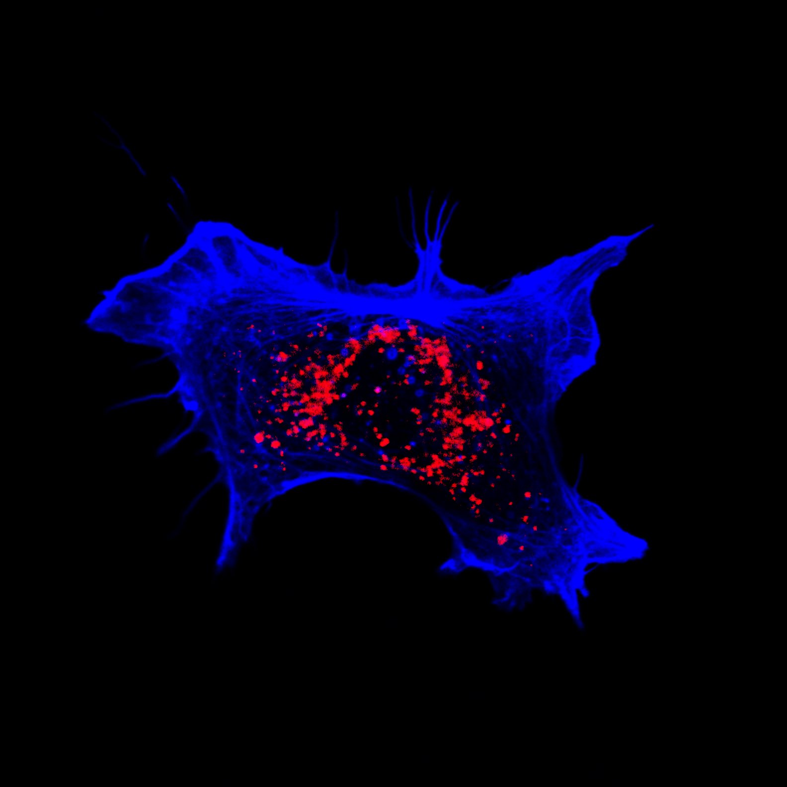 Primary fetal mouse astrocyte showing dense perinuclear lysosomal accumulation with stellate GFAP morphology