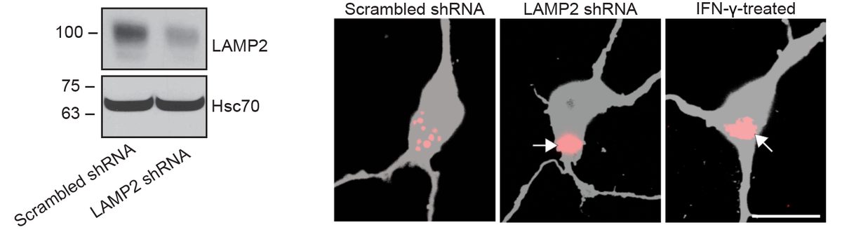 LAMP2 shRNA knockdown: Western blot validation and confocal showing inclusion formation