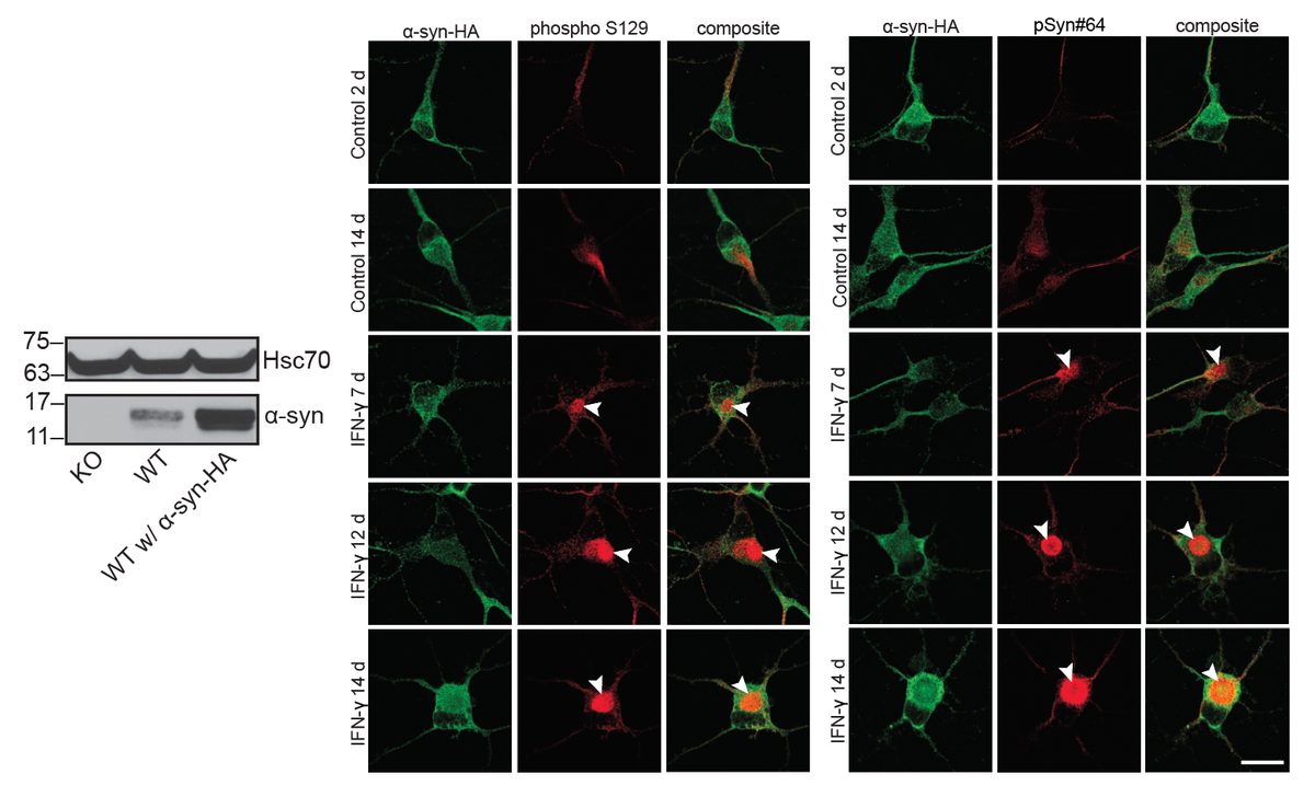 IFN-γ-treated iPSC-DA neurons