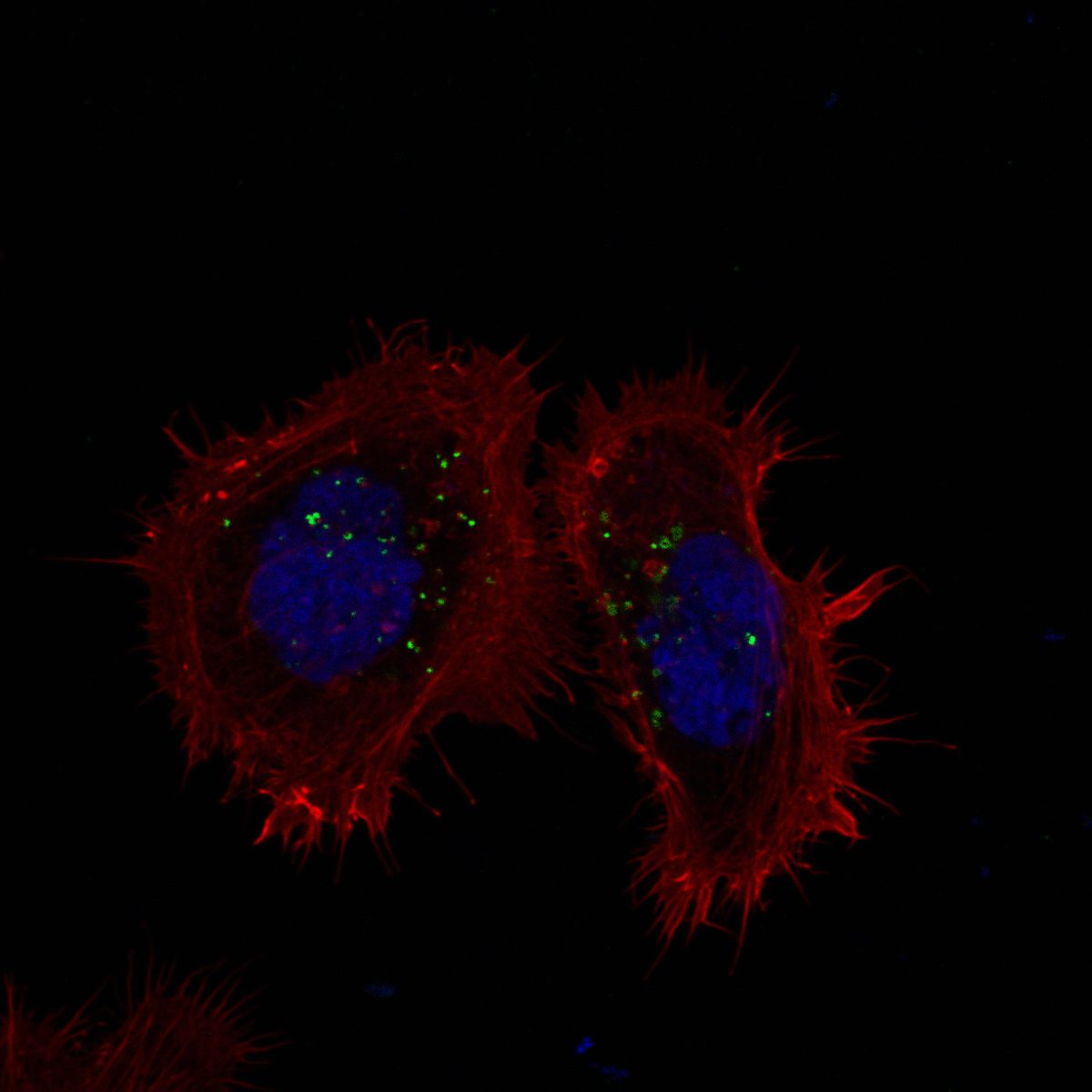 Calu-3 epithelial cells with CK2 marker and spike puncta