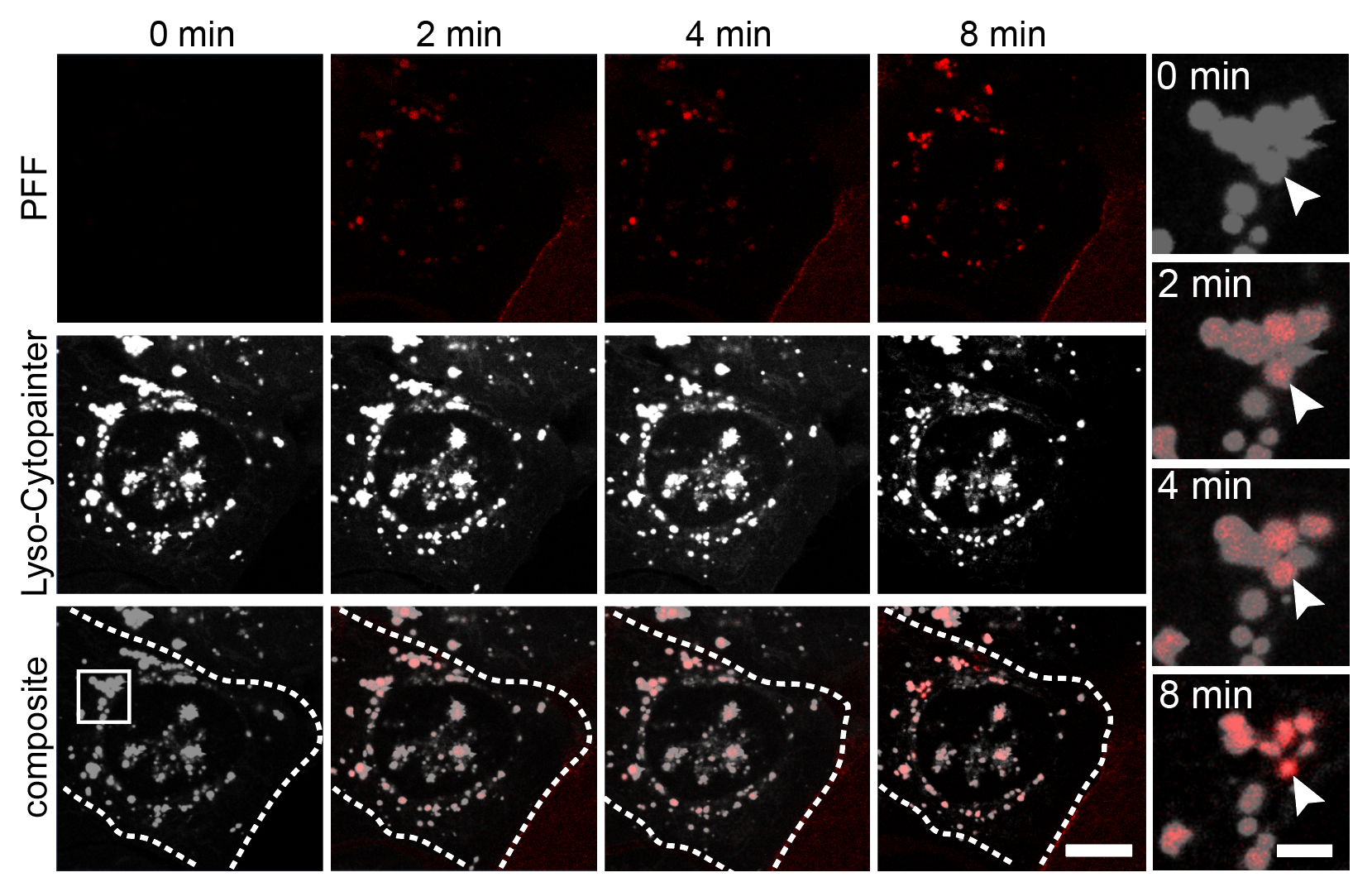Confocal: Rapid fibril uptake and lysosomal colocalization