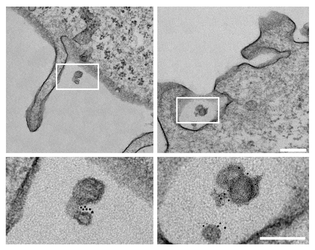 EM: Gold-labeled PFFs associated with exosomes at recipient cell membrane