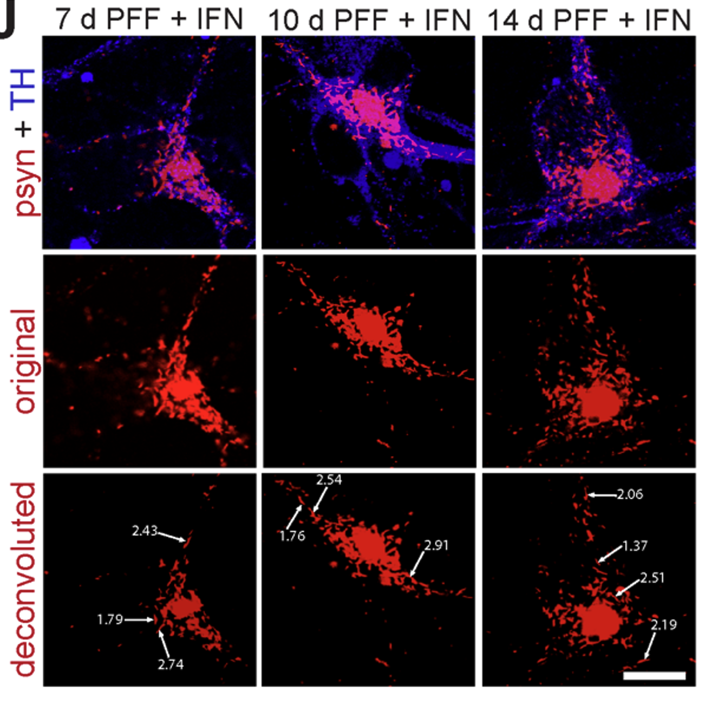Phospho-α-synuclein accumulation