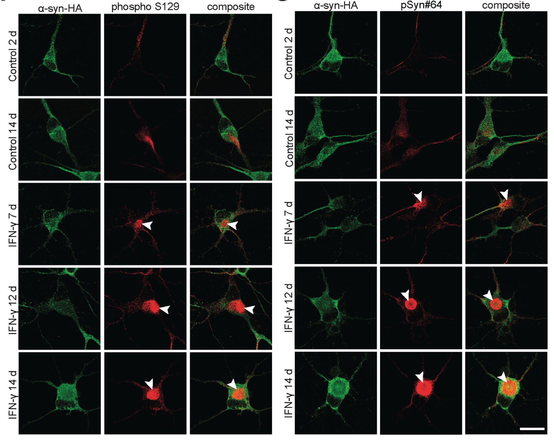 α-syn-HA with phospho S129 and pSyn#64 antibodies: control vs IFN-γ time course showing progressive inclusion formation from 2d to 14d