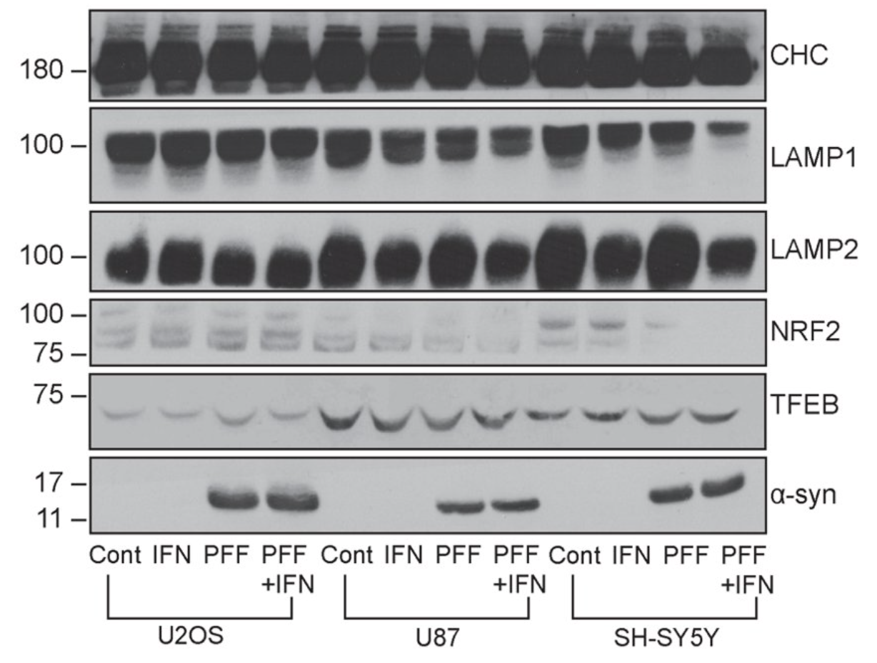 Western blot biomarker panel