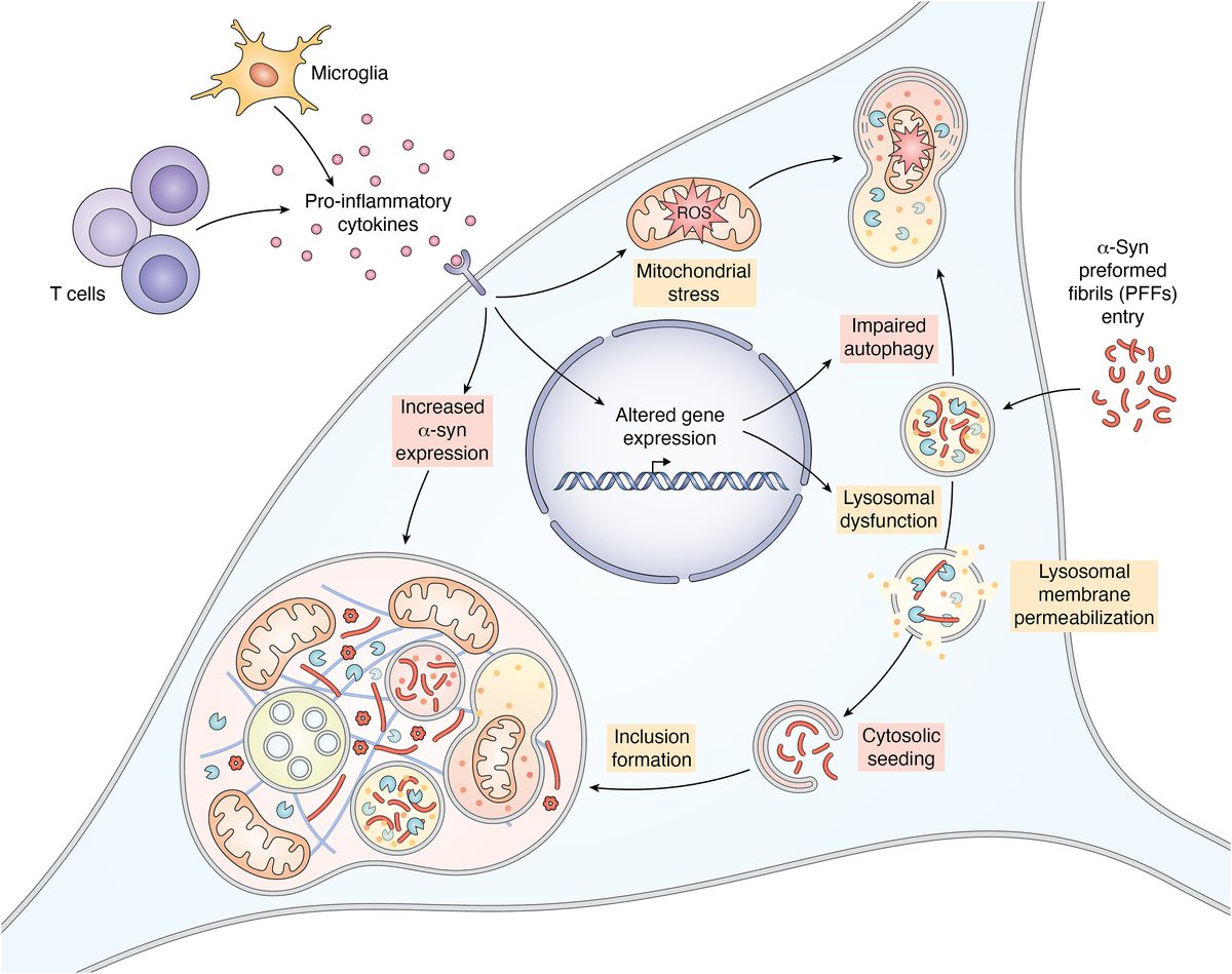 Schematic of Parkinson's disease dual-hit model: microglia activation, cytokine release, PFF entry via endocytosis, lysosomal dysfunction, and Lewy body-like inclusion formation