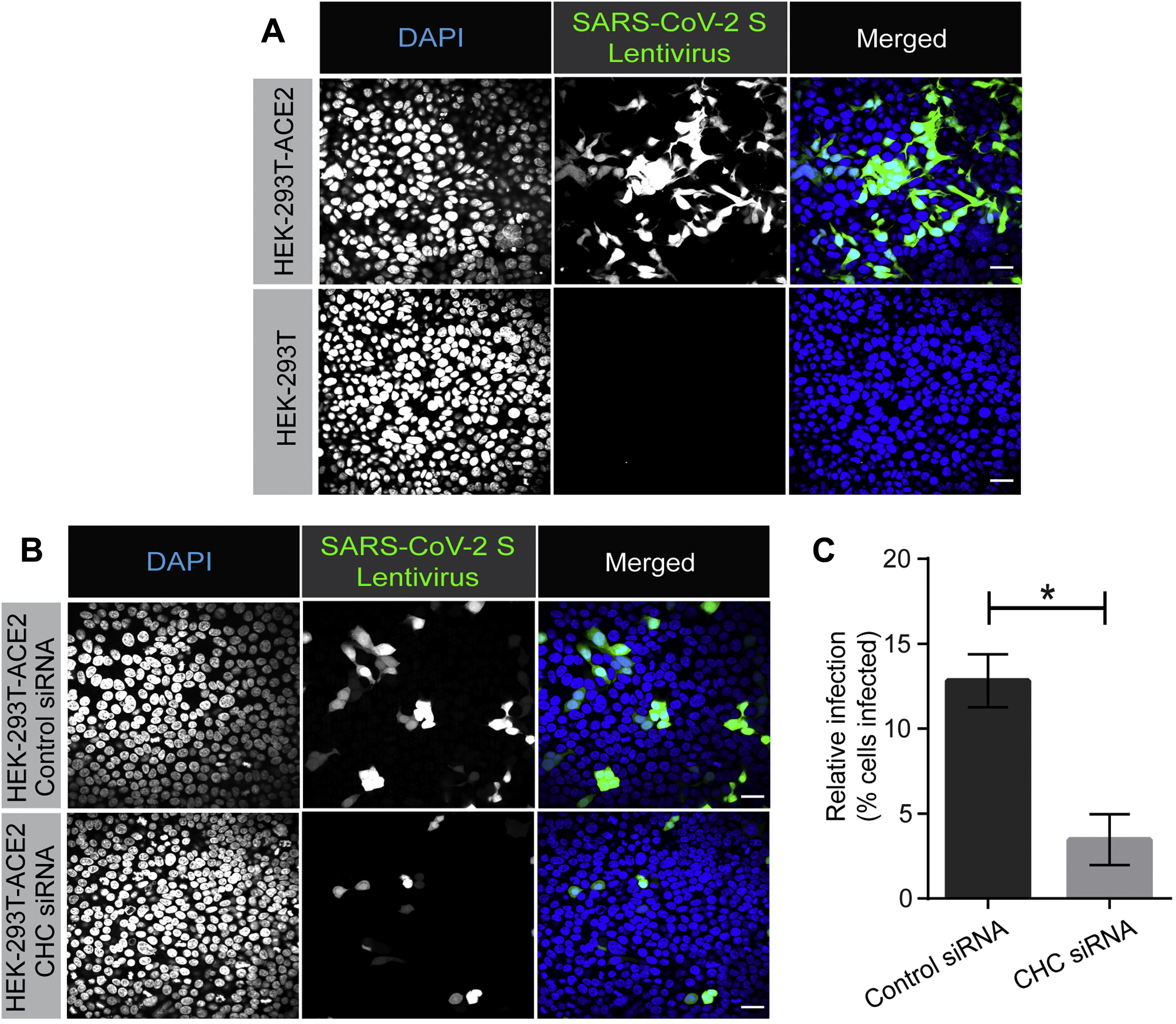SARS-CoV-2 pseudovirus GFP expression: untreated vs inhibitor-treated cells