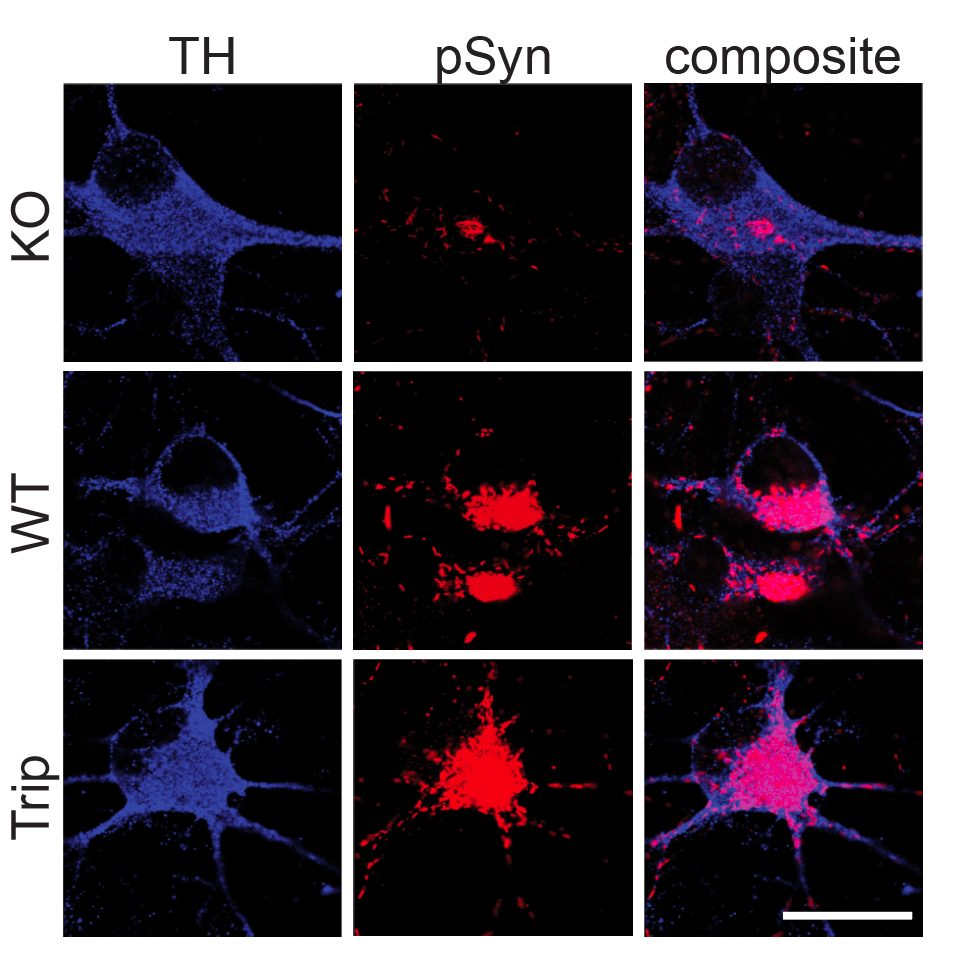 TH and pSyn in KO vs WT vs SNCA triplication DA neurons