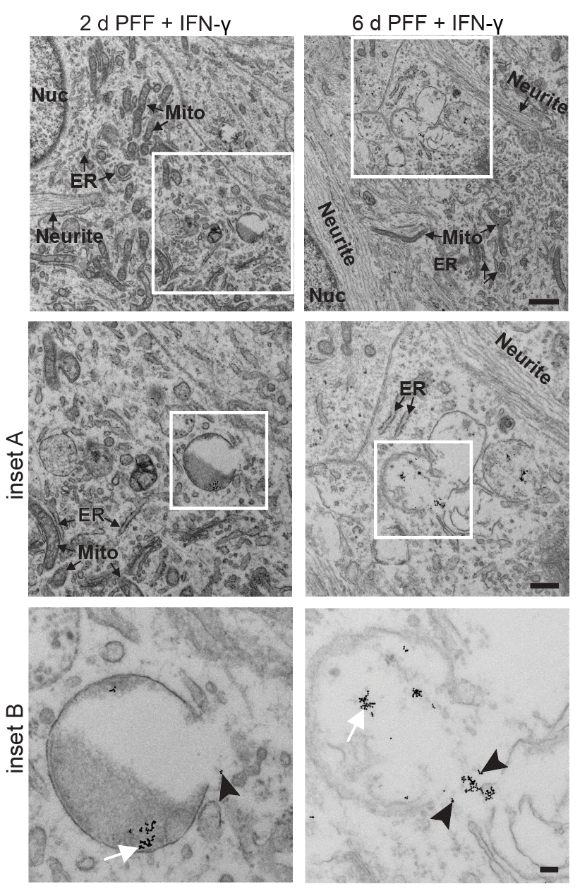 Electron microscopy of multilamellar bodies