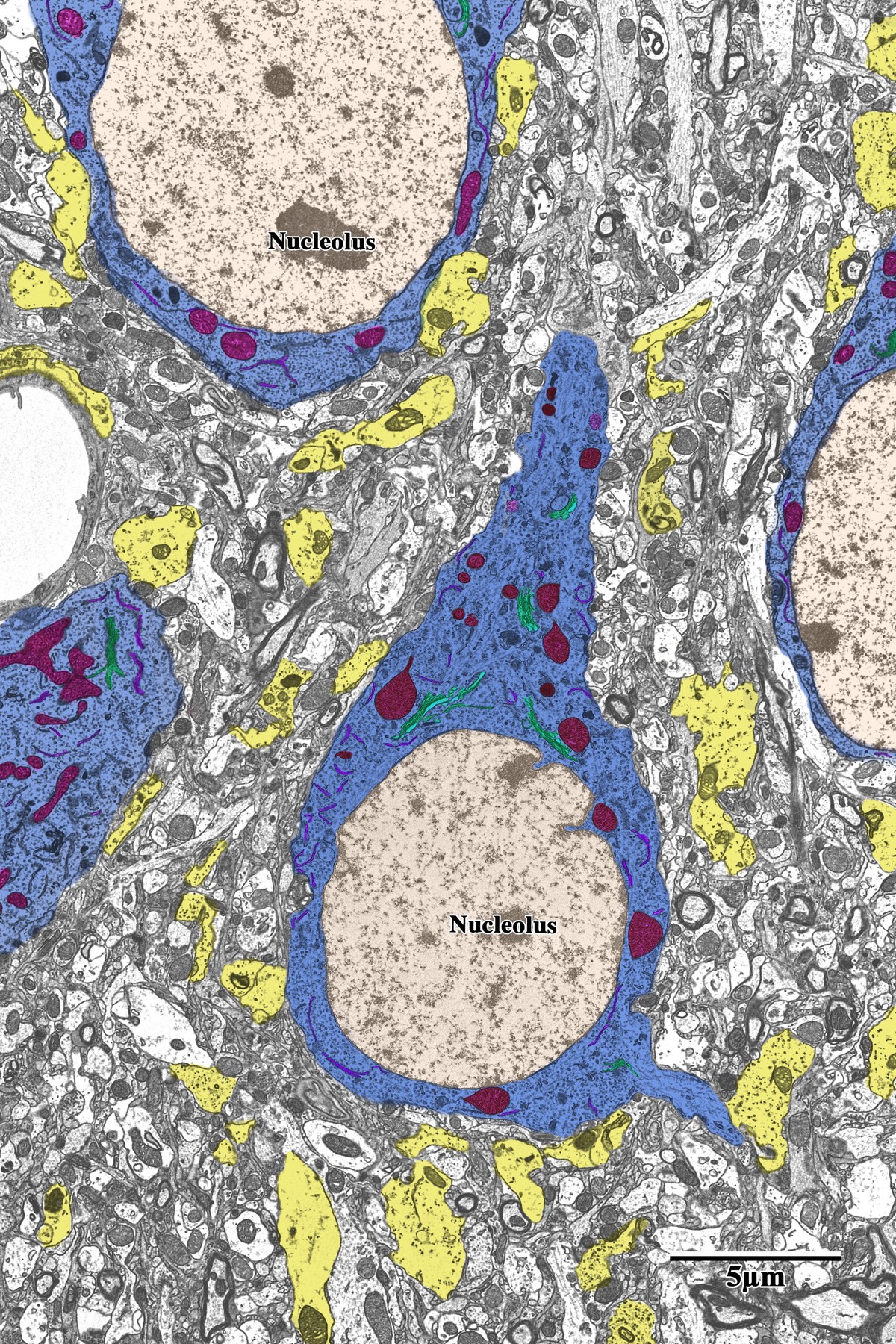 Pseudocolored TEM overview showing neurons (blue), astrocytes (yellow), mitochondria (red)