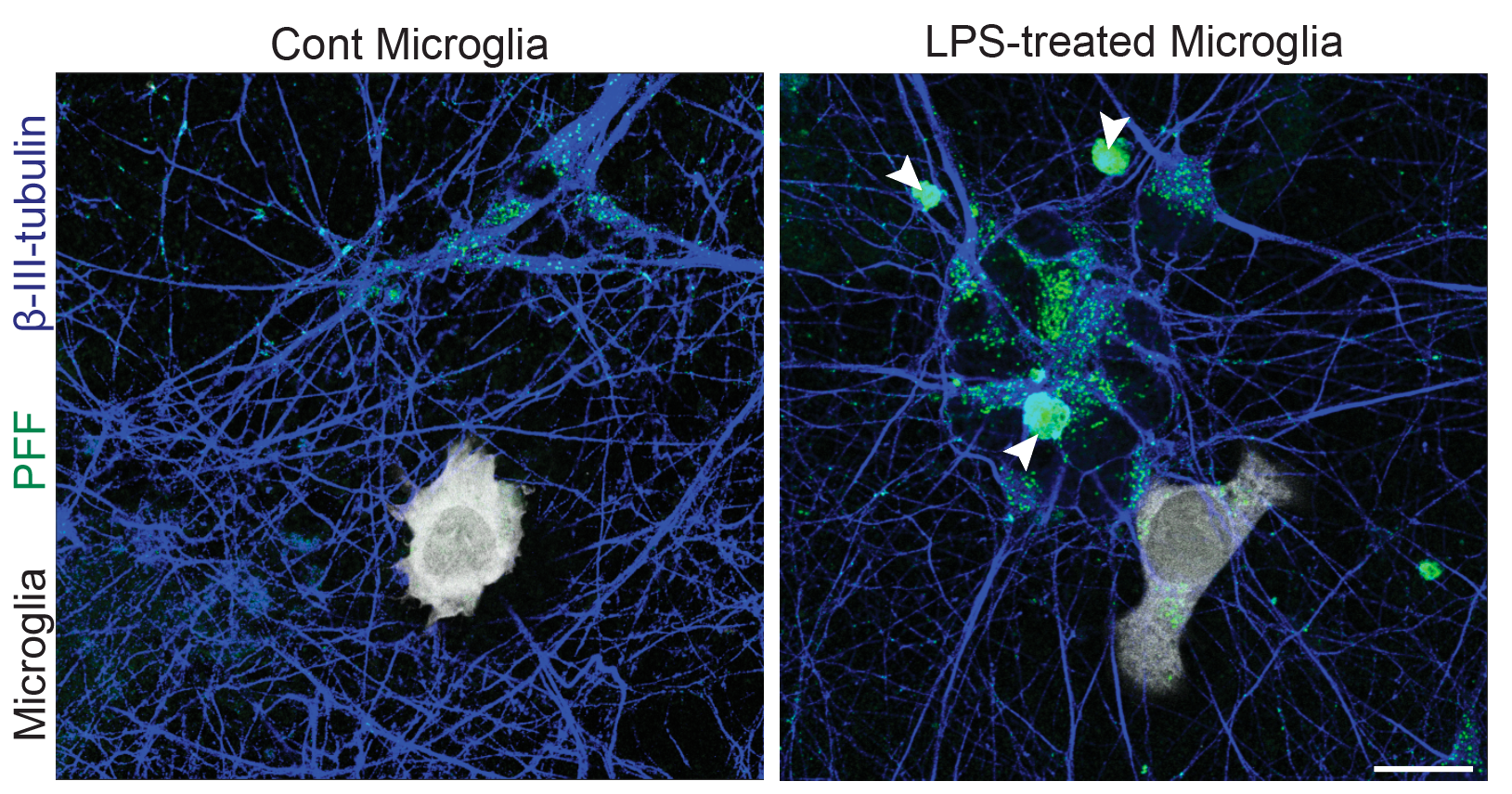 iPSC-derived microglia in co-culture