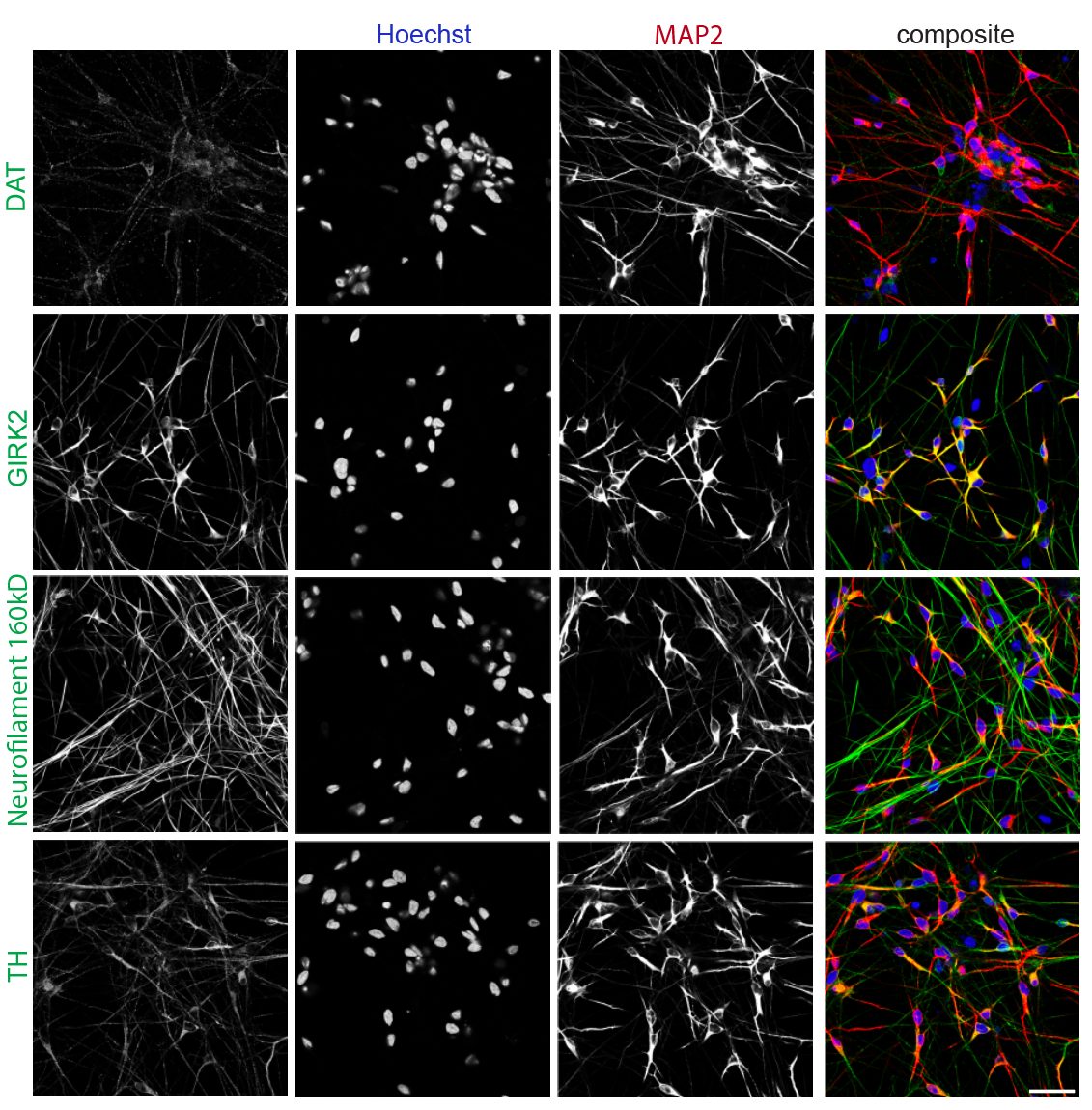 ICC characterization panel: DAT, GIRK2, Neurofilament 160kD, TH with Hoechst, MAP2, and composite overlays in iPSC-derived DA neurons