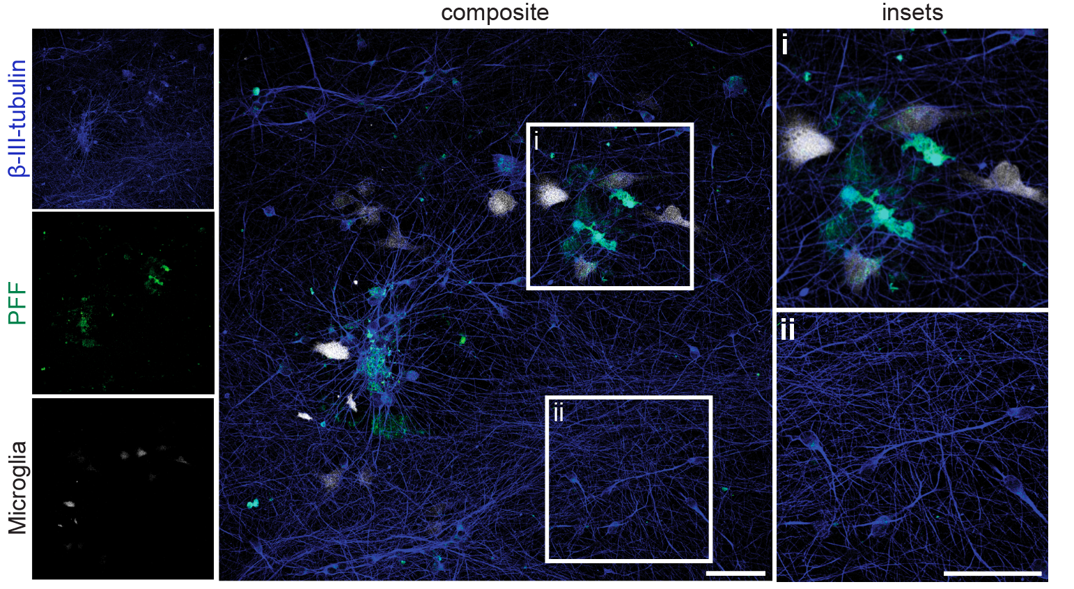 Confocal: Multiplexed neuron–glia co-culture imaging