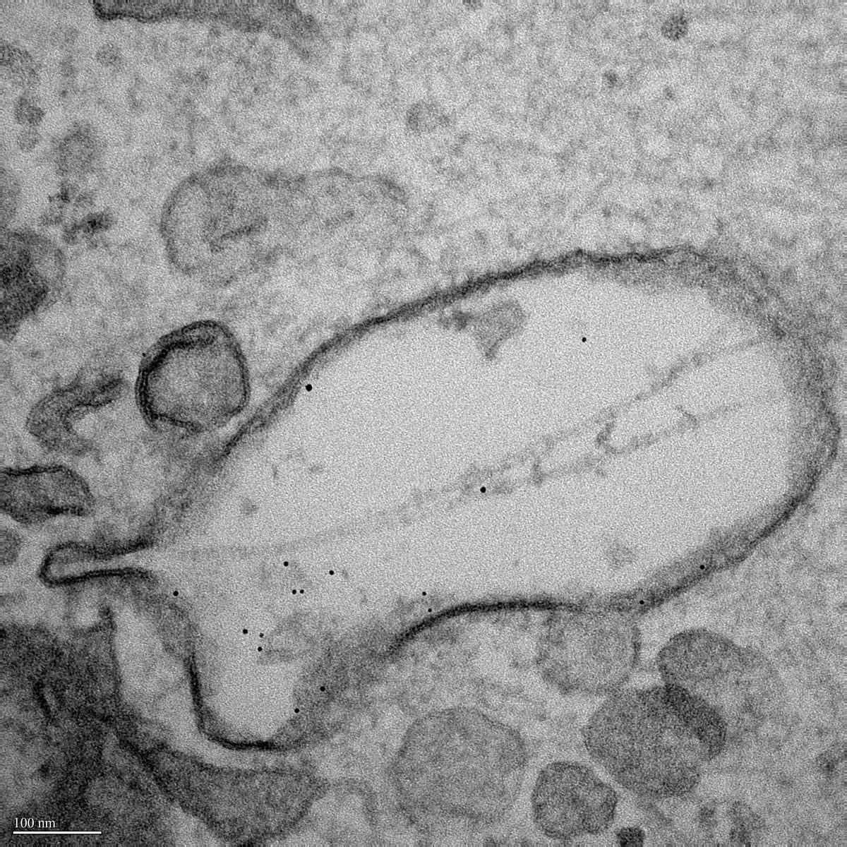 TEM 49000X showing nanogold-labeled fibrils in multivesicular body