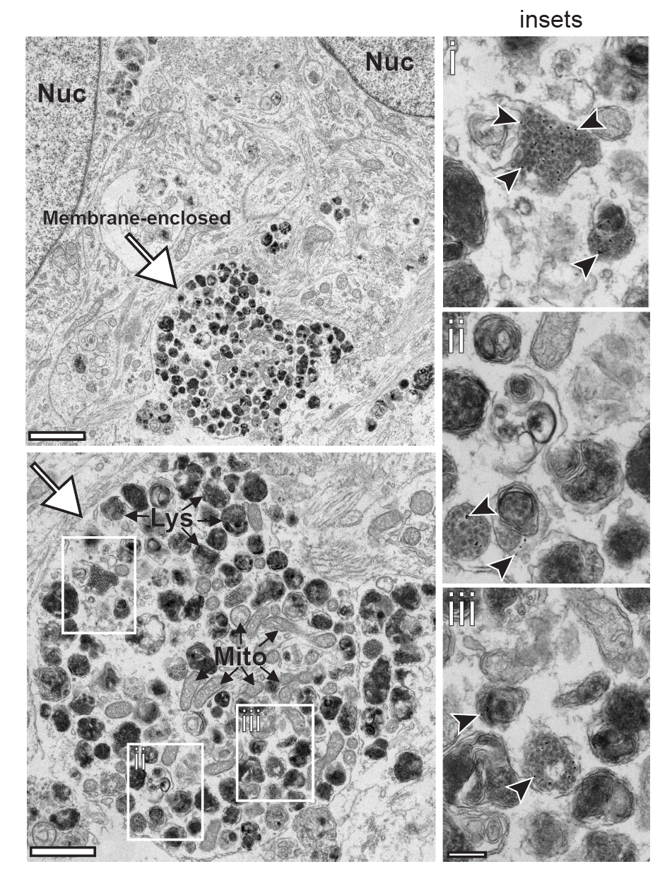 EM: Lewy body–like inclusions — overview, fibrils, nanogold trafficking, and lysosomal targeting