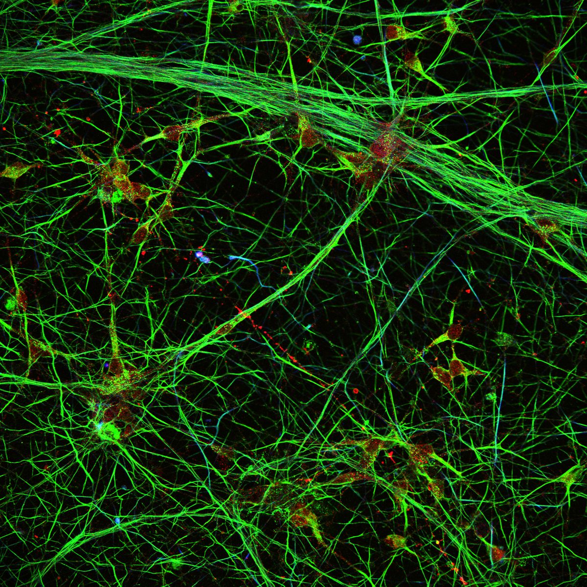 DA neuron network: Vimentin, PFF-488, gamma-tubulin, TUJ1 overlay