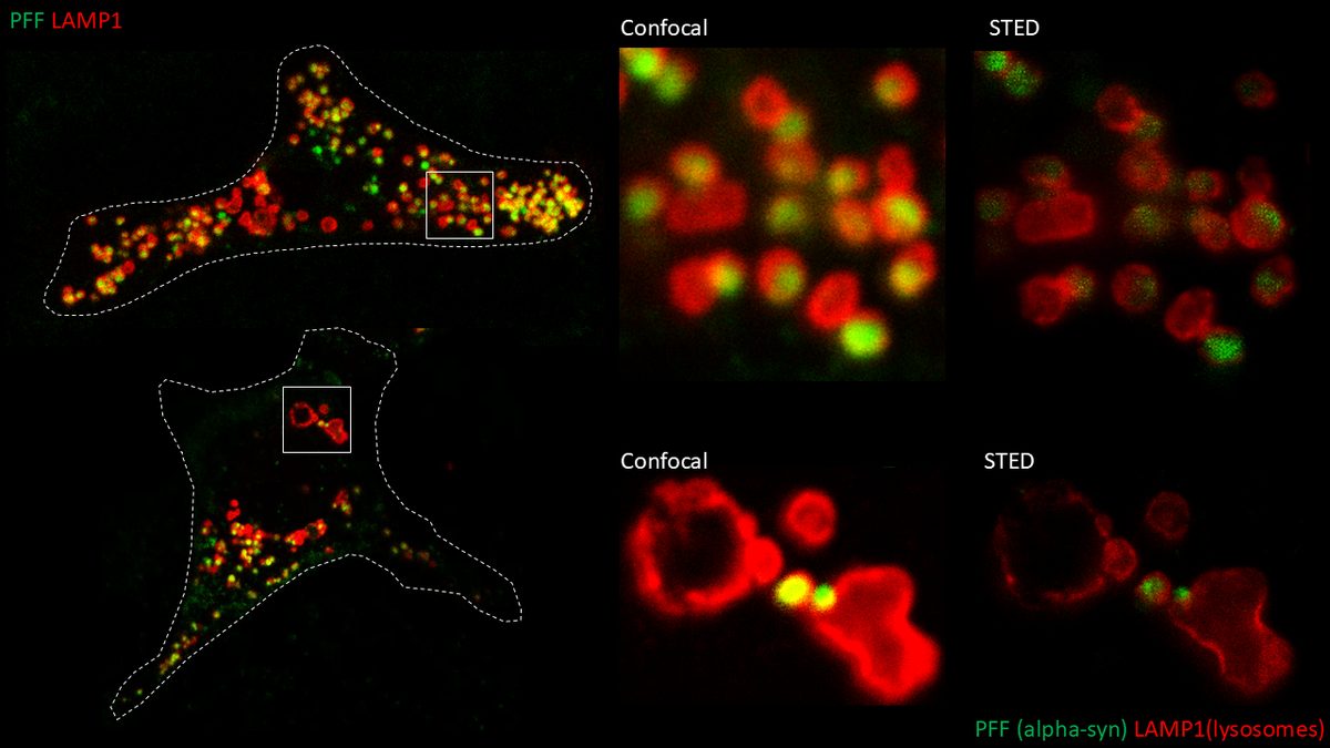 STED vs Confocal comparison showing sub-lysosomal fibril resolution