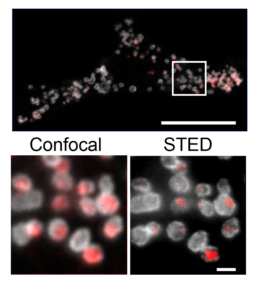 STED: Sub-lysosomal fibril localization