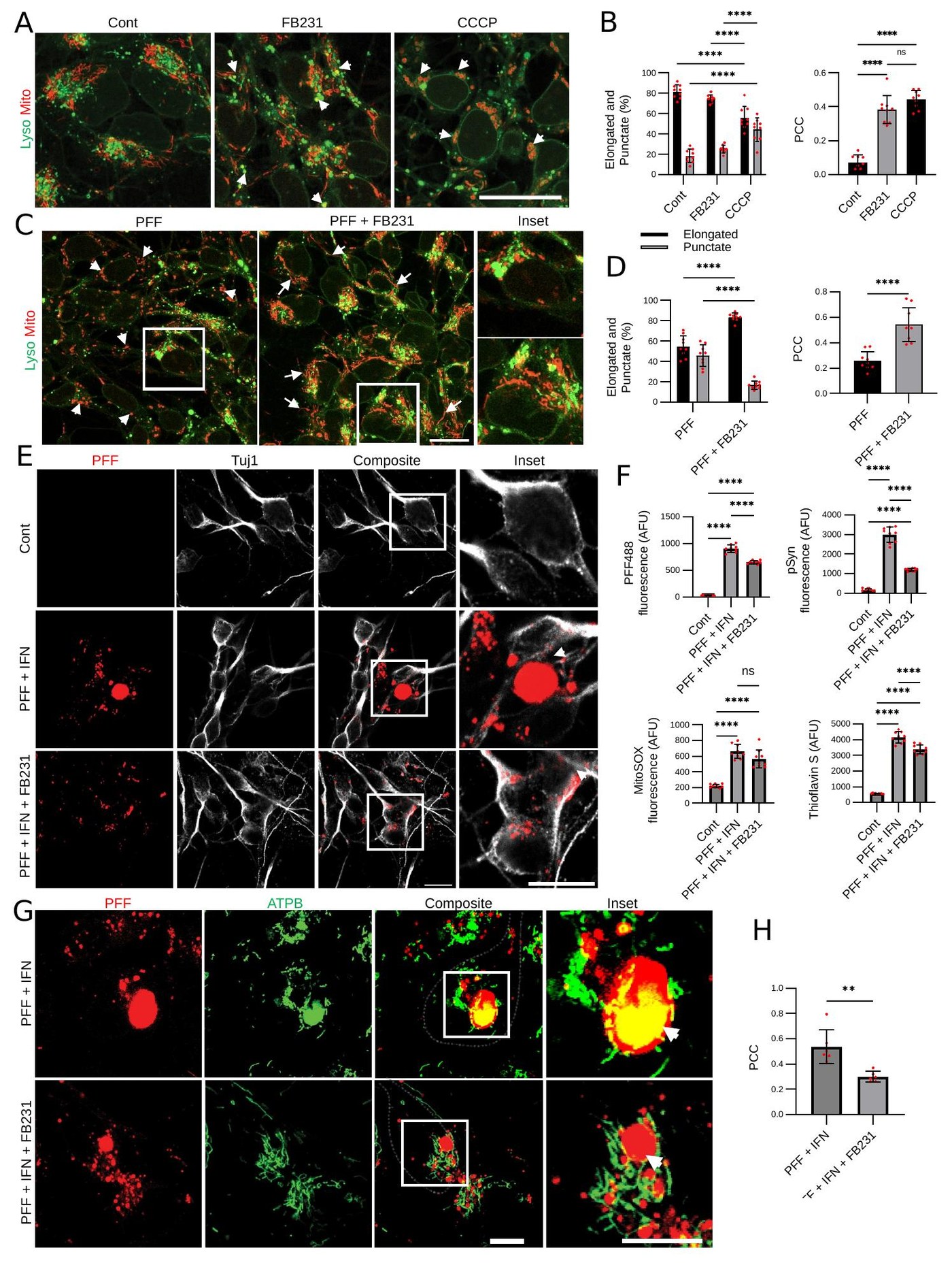 Figure 4 - FB231 rescue in human iPSC-derived dopaminergic neurons