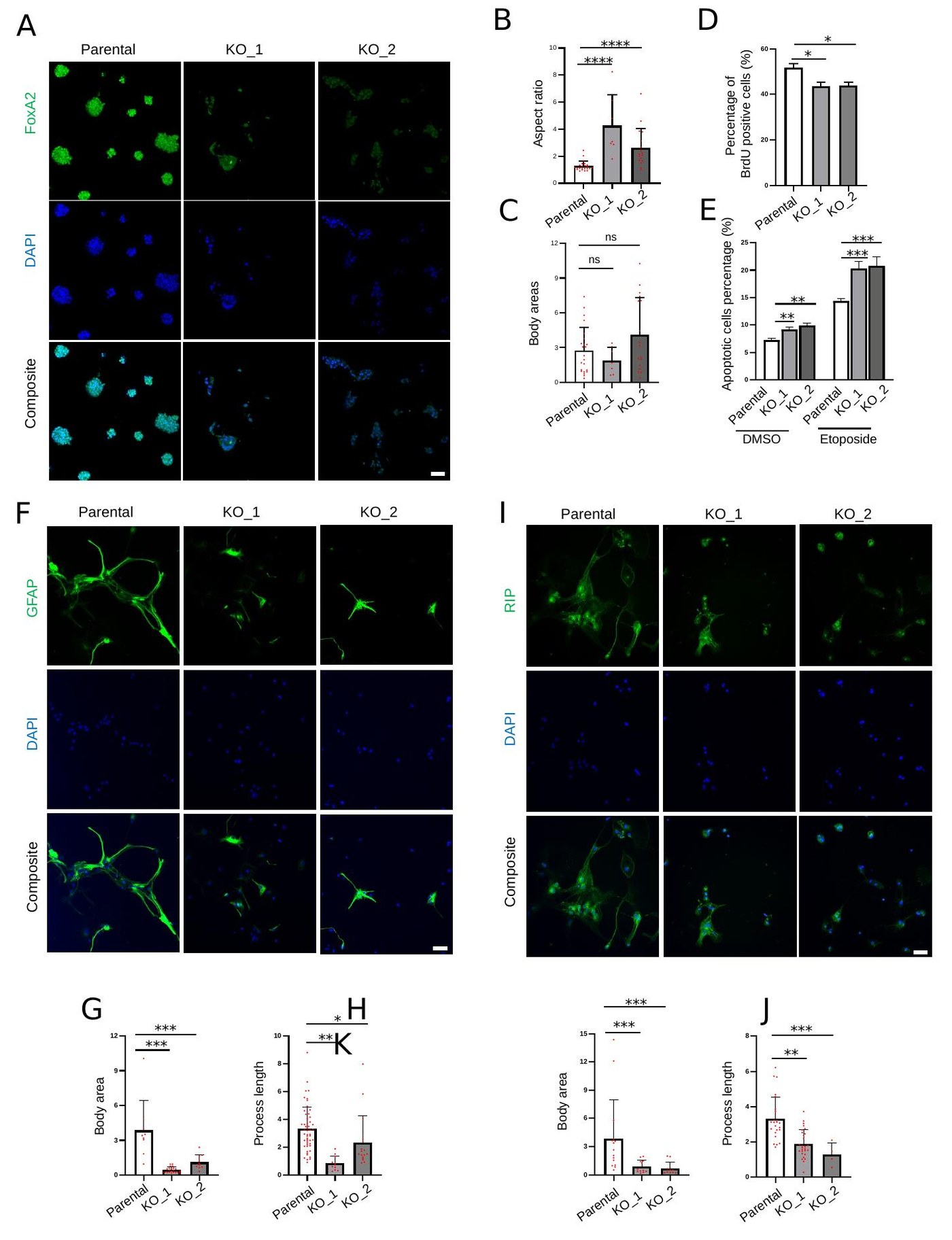 Figure S1 - NPC immunofluorescence and morphological quantification