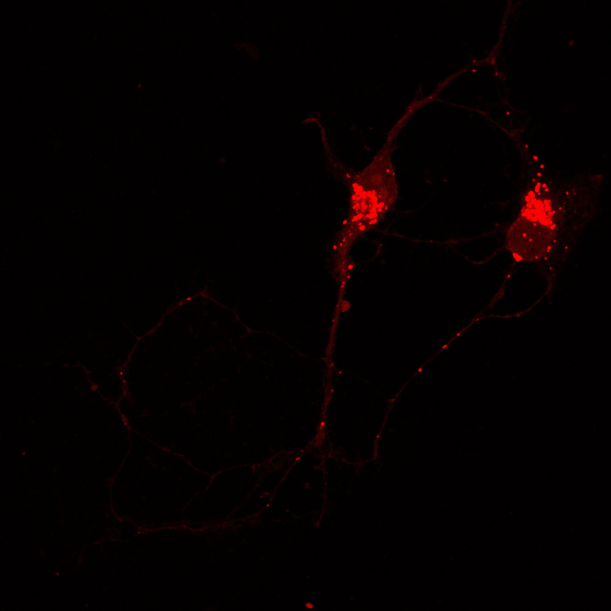 Primary rat hippocampal neuron — LysoTracker Red staining, 2-minute exposure showing perinuclear lysosomal clusters